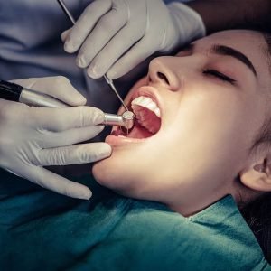 root-canal-treatment